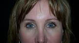Eyebrows After