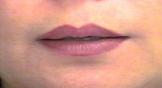 Lips II After