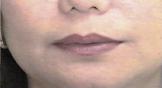 Lips II Before