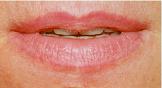 Lips Before